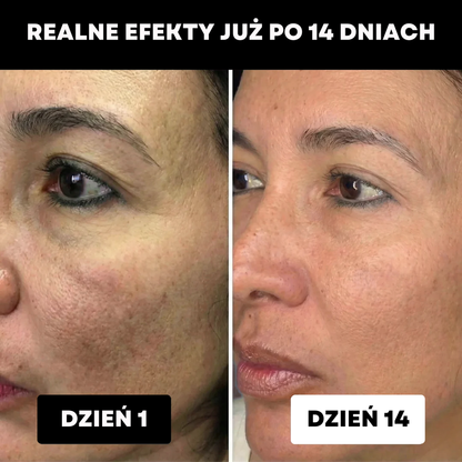 Słuchawka prysznicowa – ochrona skóry